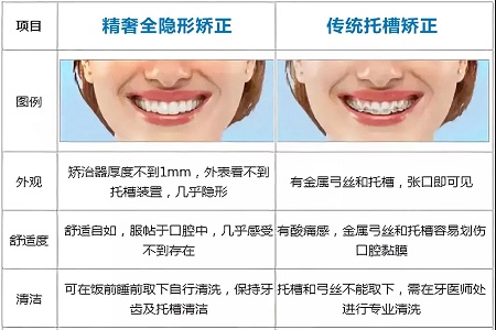 這種牙齒矯正方式，96%的人都會(huì)選擇！