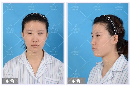 顏值：修復(fù)后的雙眼，美瞎一路