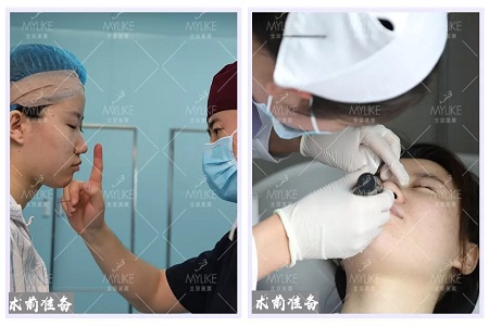 顏值：修復(fù)后的雙眼，美瞎一路