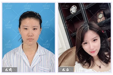顏值：修復(fù)后的雙眼，美瞎一路