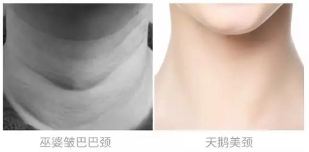 悄咪咪的年輕十歲，撫平頸紋一起“嗨”