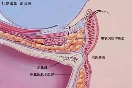 顯老淚溝，你還要任其放肆嗎？
