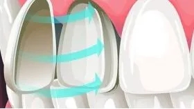 牙齒也能敷“面膜”？這款明星美牙秘籍了解下
