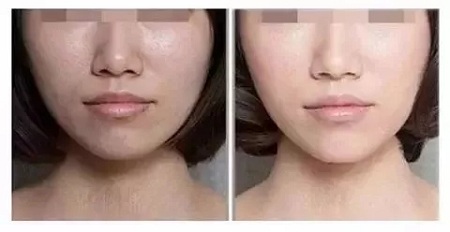 粗糙、毛孔粗大、起皮......換季肌膚問題如何解決？