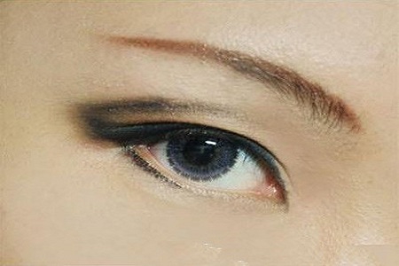 據(jù)說80%的亞洲女性都有這一眼部通病，上瞼下垂你了解過嗎？