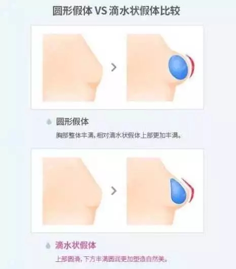 [我問大醫(yī)師]隆乳手術(shù)問題，你想要的答案，這里都有