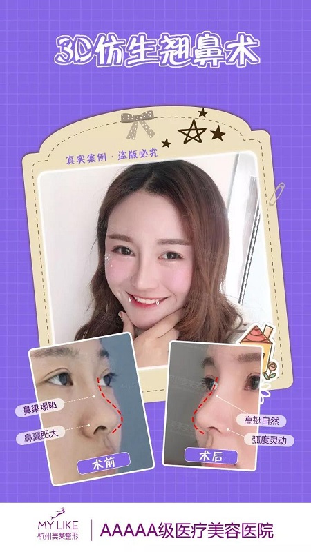CURE全度美眸，仿生3D翹鼻，想美哪里你來定