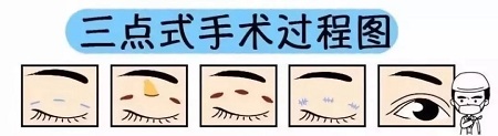 美眼張誠坐診美萊，淺談為什么你的眼睛不夠美？