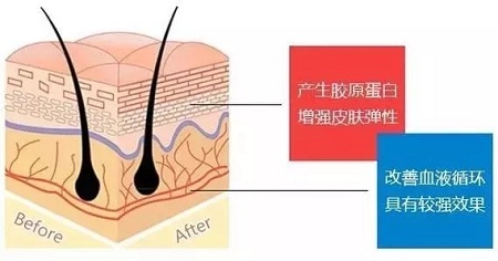 關(guān)于*雕，你想了解的都在這里！