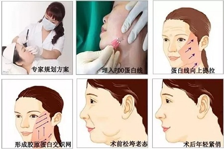 關(guān)于*雕，你想了解的都在這里！