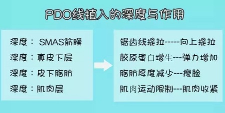 關(guān)于*雕，你想了解的都在這里！