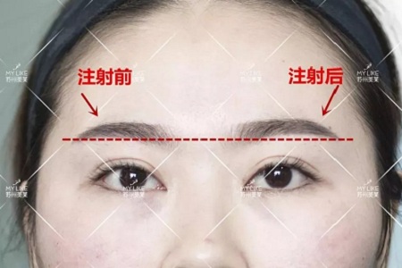 想要?dú)W式大眼，一定要注意與這個(gè)部位協(xié)調(diào)！