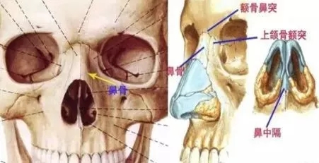 側(cè)面看鼻梁不矮,正面看鼻子卻很塌是什么原因？