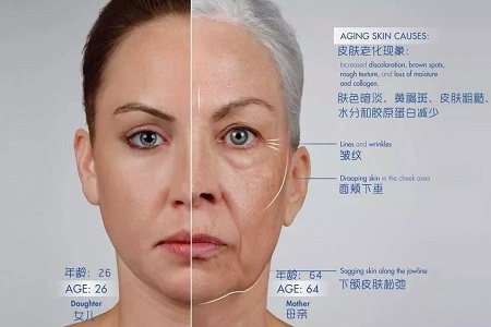皺紋、松垂、凹陷，三大衰老癥狀，怎么解決？