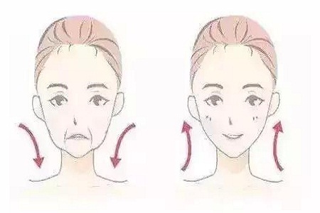 同樣是填充玻尿酸，效果為什么不同