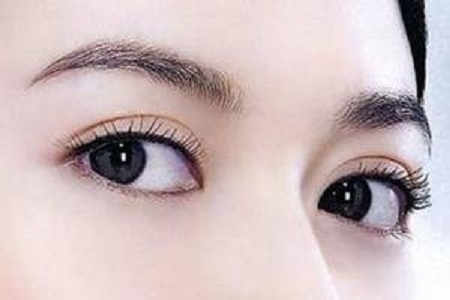 開(kāi)眼角手術(shù)費(fèi)用多少 媚眼勾魂！
