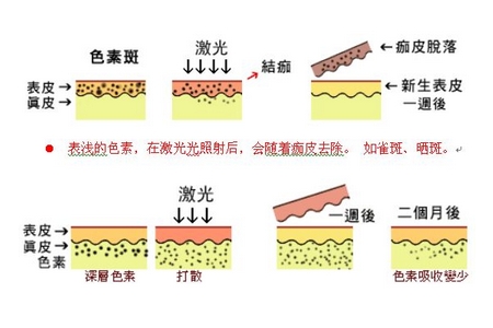 祛斑方法有哪幾種？這些祛斑小妙招你需要掌握