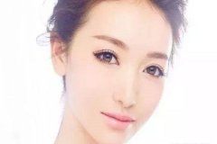 寧波下巴整形恢復時間 讓你擁有完美側(cè)顏