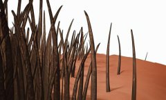 發(fā)際線后移做植發(fā)手術(shù)有用嗎，需要多少錢