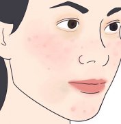 美萊醫(yī)生介紹讓你「不花冤枉錢」的嫩膚攻略，把錢花在刀刃上